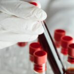 Dünyada sadece 50 kişide var! ‘Altın kan’ın sırrı çözülüyor: Bir damlası bile servet değerinde!