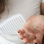 “Saç Dökülmesi Sorununuz Genetik Değil, Alışkanlıklarınızı Gözden Geçirin!”